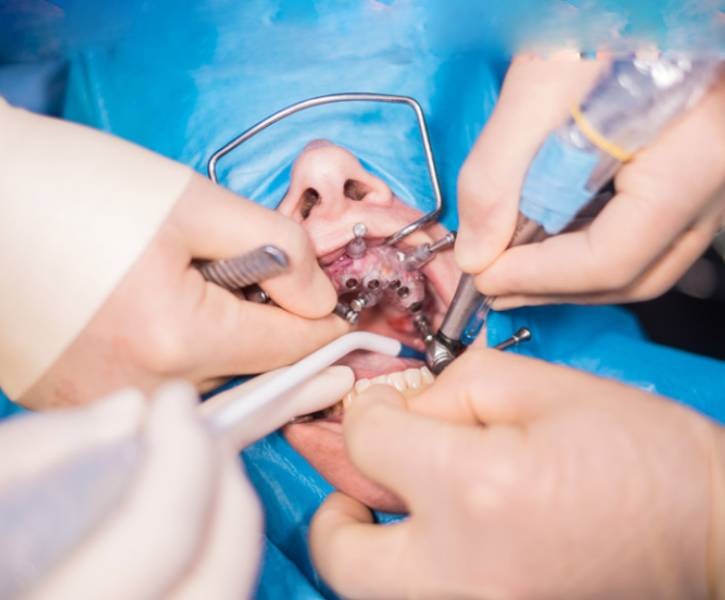 Dental Surgery