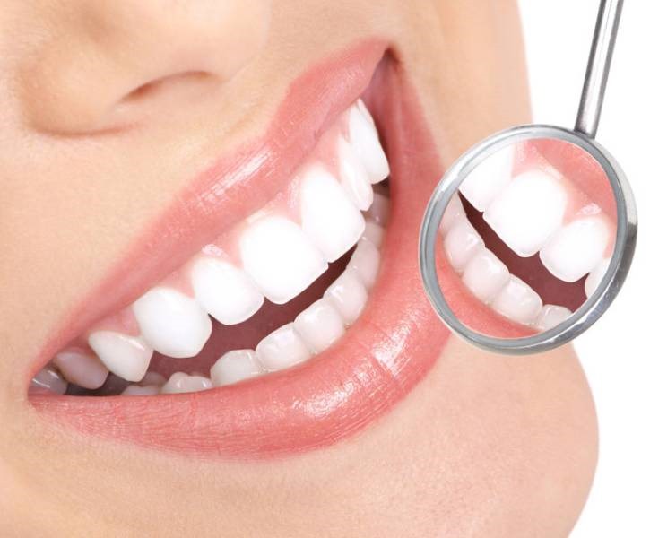 Smile Design